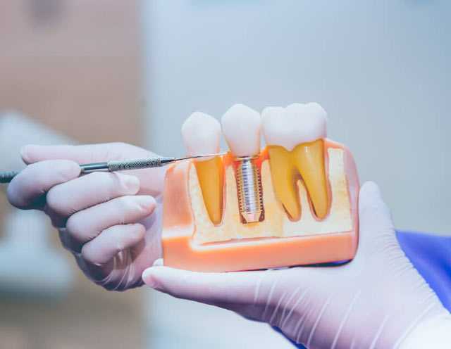 نمایشگاه دندانپزشکی و فناوری‌های دیجیتال (dental confex)