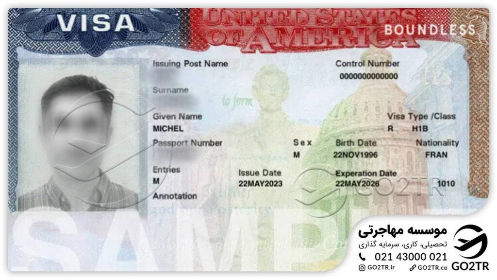 نمونه ویزای H-1B آمریکا- مهاجرت دندانپزشکان به آمریکا