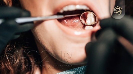 تخصص دندانپزشکی در گواتمالا و شرایط اخذ پذیرش تخصص دندانپزشکی در گواتمالا