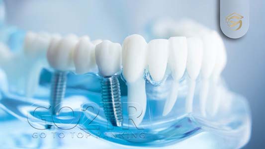 تخصص دندانپزشکی در الجزایر و شرایط اخذ پذیرش تخصص دندانپزشکی در الجزایر
